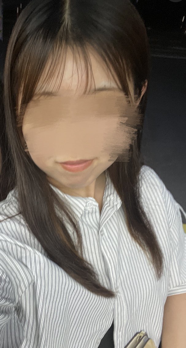 218malu's tweet photo. 人生で一番やって良かったことかもしれない。

Before → After

努力はちゃんと変化になる(⸝⸝ɞ̴̶̷ ·̫ ‹⸝⸝ᐡ)~☆
#渡韓整形 https://t.co/R4rFjHR3Nl