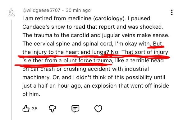 ValVenisEnt's tweet photo. WAKE THE F UP @RealCandaceO!!!!! He was STRUCK WITH A SMALL CALIBER BULLET FIRED BY RICK CUTLER! 

KINETIC ENERGY OF THE BULLET -> METAL CROSS -> CHEST (DAMAGING BOTH THE HEART AND LUNGS - RICOCHETED MANGLED BULLET UPWARD INTO CKs NECK! https://t.co/lWrgPYSjW4