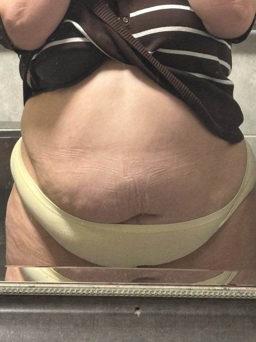 strawberryycoke's tweet photo. soooooo i’ve officially reached 300 pounds :p im such a fat cow ! thinking of opening an OF acc, what do you think?? should i? 

#feedee #feedercattle #feederism #feedeetwt #feedeebelly #curvygirl #fattwt https://t.co/U8WP21LSxz