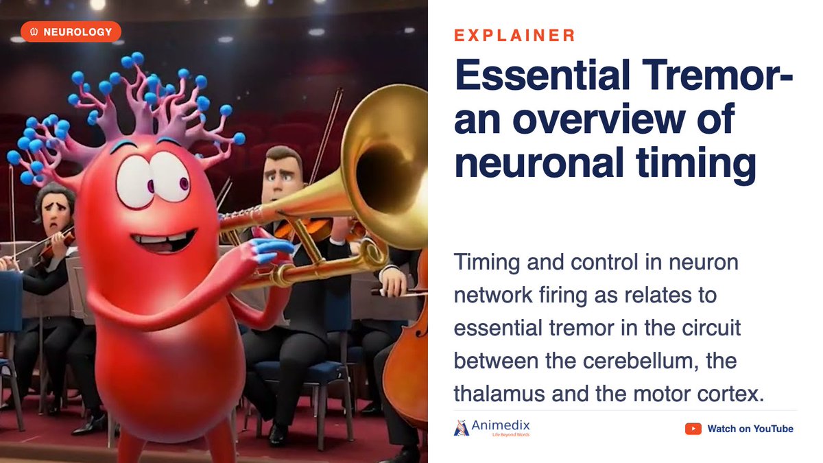 animedixppm's tweet photo. Essential Tremor- an overview of neuronal timing. This video provides an overview of timing and control in neuron network firing as…

https://t.co/5H170gDQij

#Neurology #MedEd #Animedix https://t.co/NaH2ptIfDj