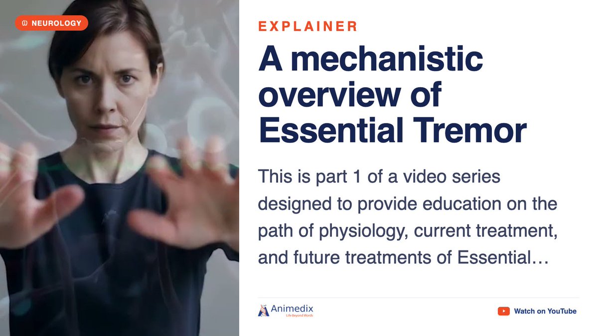 animedixppm's tweet photo. A mechanistic overview of Essential Tremor. This is part 1 of a video series designed to provide education on the path of…

https://t.co/246YF7SyBB

#Neurology #MedEd #Animedix https://t.co/uILjko0EOx