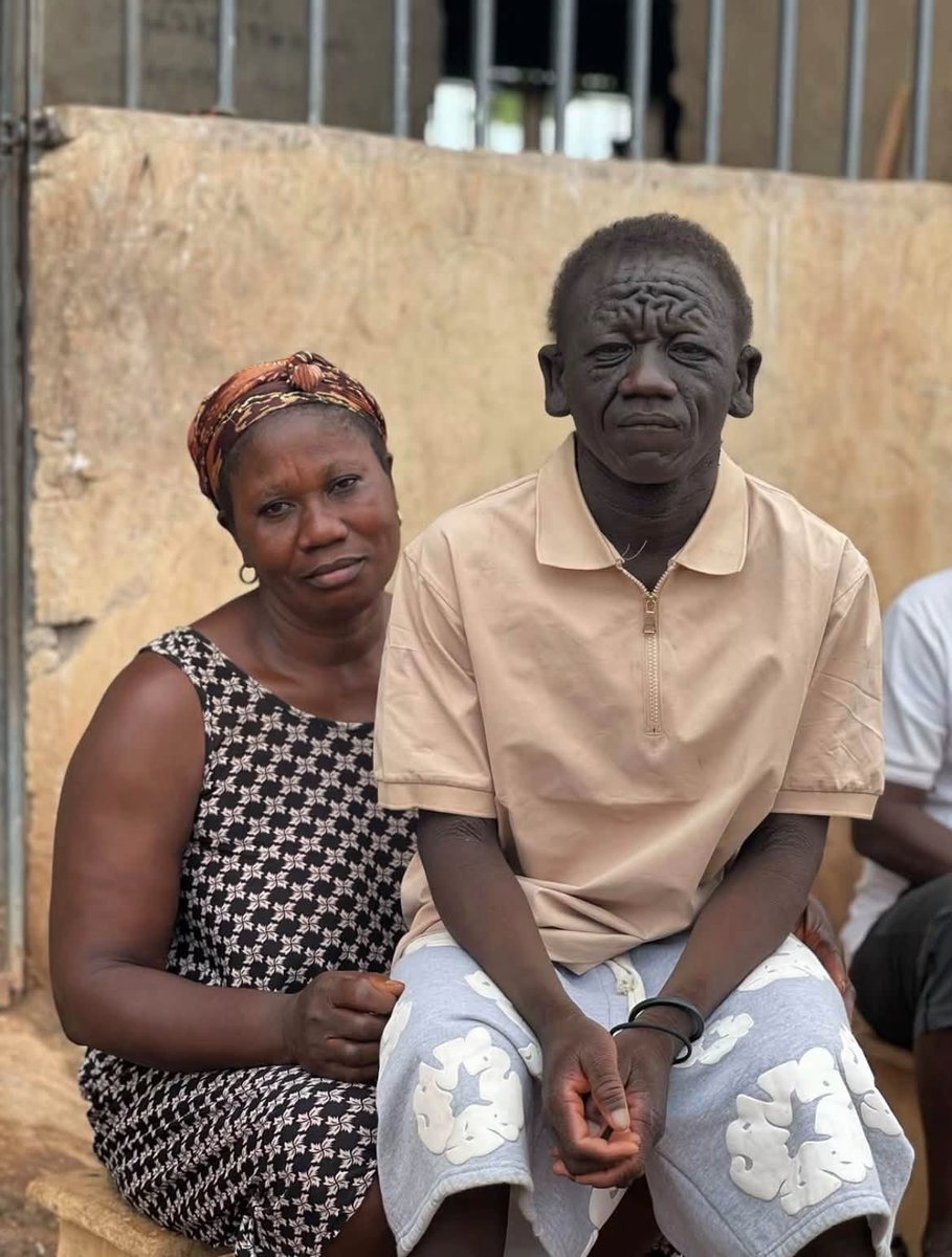 idreezsadam1's tweet photo. This young man is Tano Hayford, popularly known as Olu Ngbe.

He was reportedly expelled from school and rejected by several trade masters because people feared and misunderstood his rare genetic condition. 💔

Imagine being denied an education and the chance to learn a skill simply because of how you look.

If this happened to your child or sibling, how would you feel? 🤔

We still have a long way to go in creating awareness and ending discrimination against people living with rare genetic conditions.