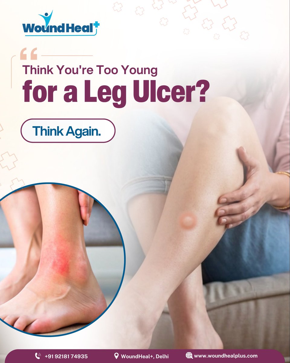 WoundHealPlus's tweet photo. Are you ignoring a leg ulcer because you think you’re too young?
Leg ulcers can affect younger adults too. Don’t ignore a wound that isn’t healing—early care matters.
#WoundHealPlus #LegUlcers #VenousUlcer #ArterialUlcer #VascularHealth https://t.co/z5hF5SKIPb