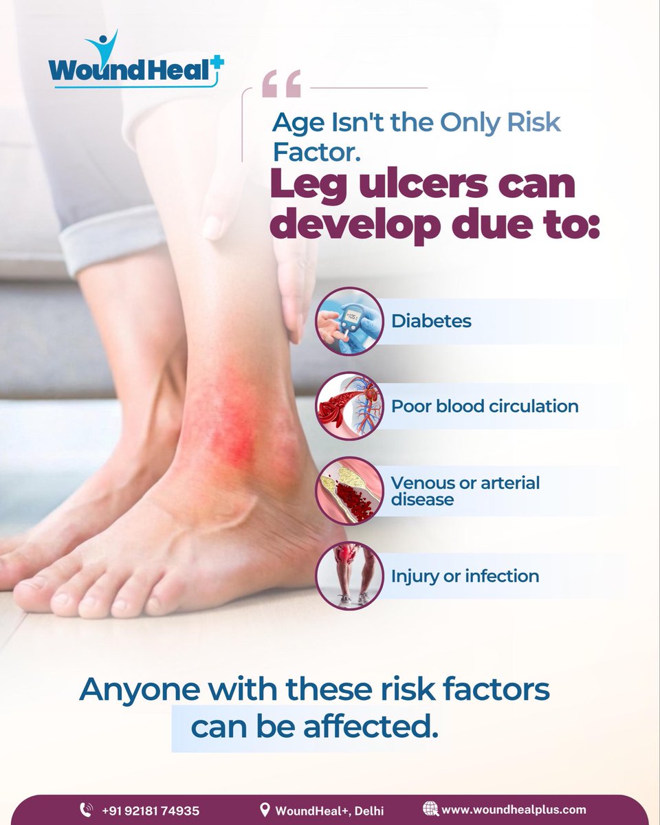 WoundHealPlus's tweet photo. Are you ignoring a leg ulcer because you think you’re too young?
Leg ulcers can affect younger adults too. Don’t ignore a wound that isn’t healing—early care matters.
#WoundHealPlus #LegUlcers #VenousUlcer #ArterialUlcer #VascularHealth https://t.co/z5hF5SKIPb