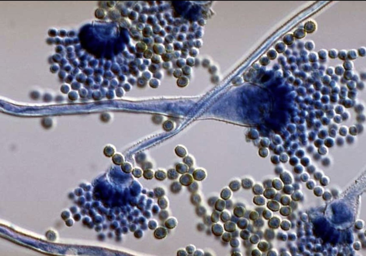 guerreroespejo's tweet photo. Las #micosis invasivas siguen siendo una amenaza infravalorada.
Un análisis del CDC encontró mortalidad hospitalaria cercana al 33% en pacientes con #aspergilosis o #mucormicosis invasivas.
Diagnóstico precoz y sospecha clínica siguen siendo fundamentales.
https://t.co/oXCT8n6yZr https://t.co/QW5DTQbsqM