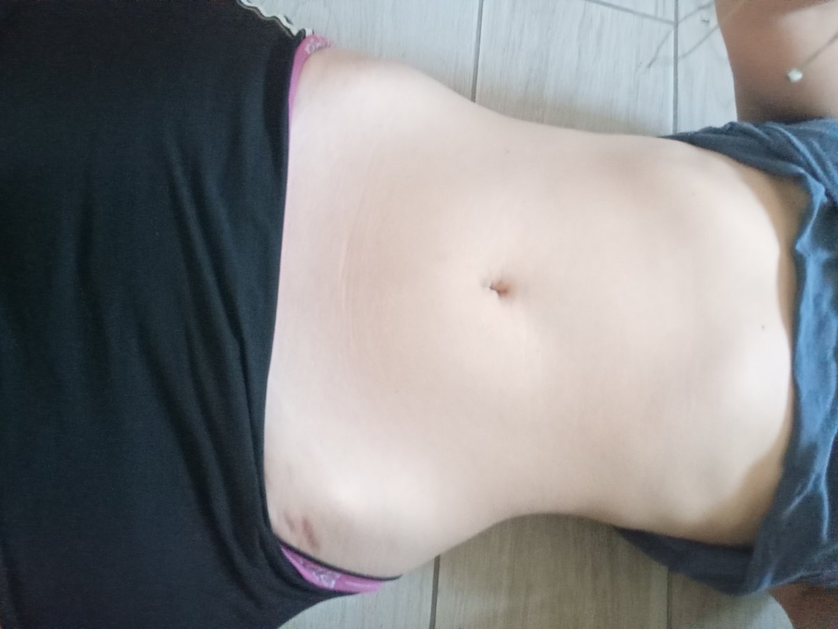 RaeIsHungry's tweet photo. i dont look even close to bmi 21 holy fatspo https://t.co/QEyWr05cKm