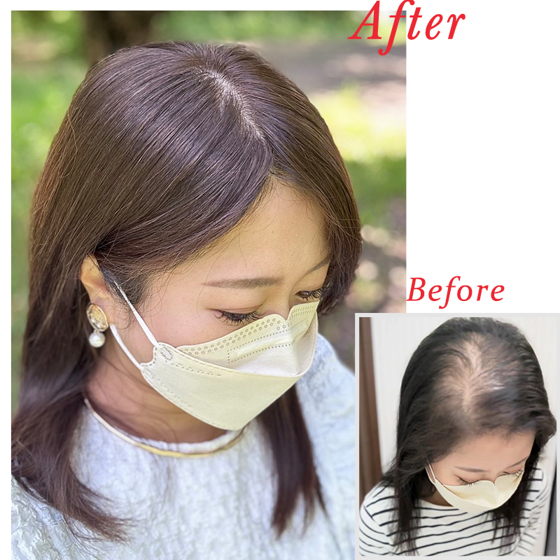 igennki's tweet photo. ✨BHADBS812✨

https://t.co/qPEaiji8vp

レミーヘアならではの、なめらかな手触りとまとまりやすさ🌿

✔ レミーヘア100％
✔ 地肌風総手植え
✔ 約8×12cmベース
✔ アレンジも楽しめる♪

毎日を快適に過ごしたい方におすすめです😊

#私元気
#私元気ウィッグ https://t.co/EgnvDaKSDb
