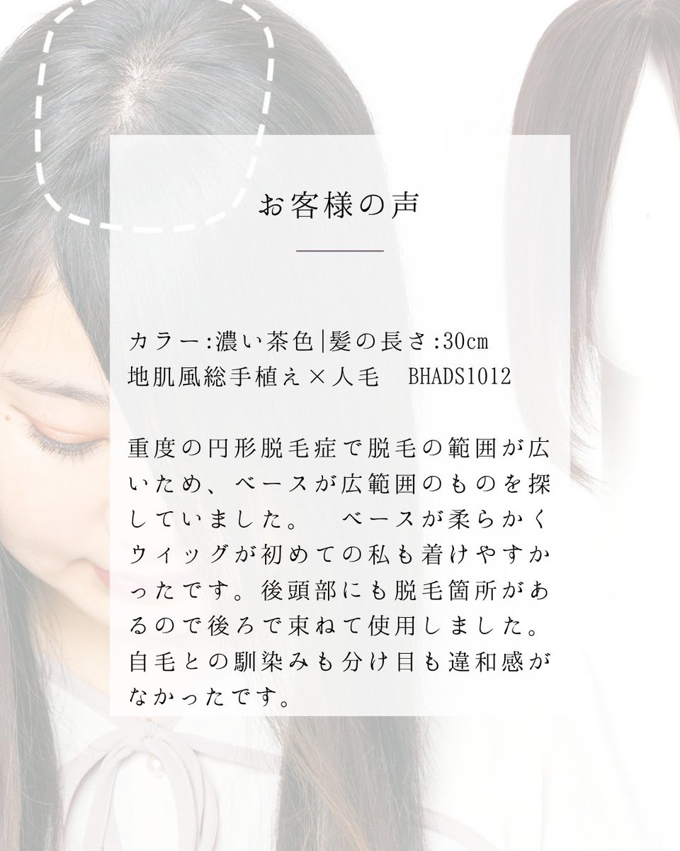 igennki's tweet photo. お客様の声✨

https://t.co/nrfhtqAOlK

広範囲カバー可能な部分ウィッグ【BHADS1012】
高級人毛で自然な頭頂部、ドライヤー・コテでスタイリングも自由💇‍♀️

「柔らかいベースで初めてでも着けやすく、後ろで束ねても自毛と自然に馴染みました」

#私元気 #私元気ウィッグ https://t.co/VLJ3Y7R0pw