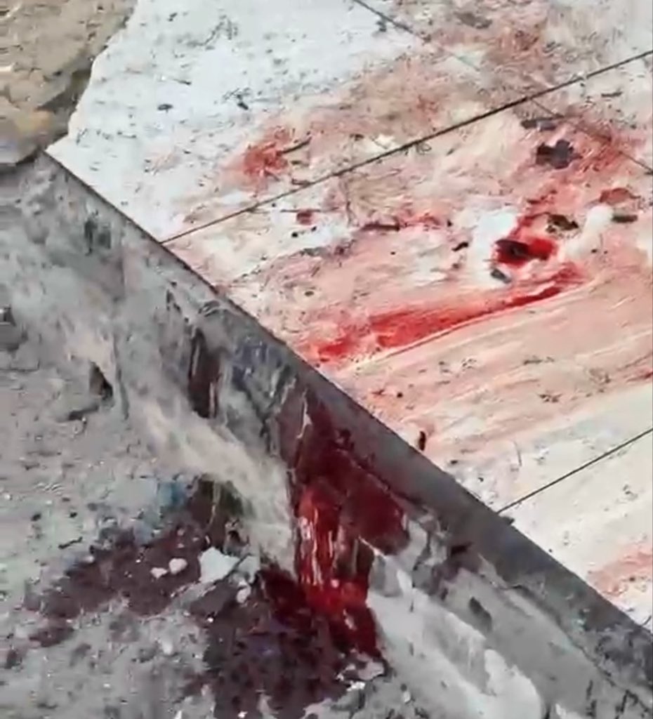Breaking: Alarming Toll of Israeli Aggression Revealed Amid Renewed Conflict