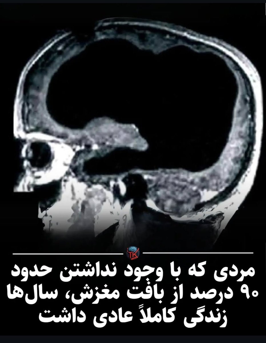 amirhossein_nam's tweet photo. عه رضا پهلوی :))) https://t.co/zrJIMOmIJH