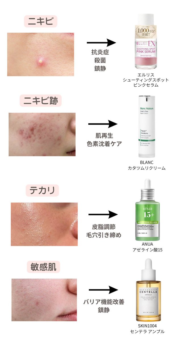 kikiq28's tweet photo. ��気でノーファンデ目指したい人‼️
美容医療も大事だけど、それ以上に日頃のスキンケアが１番効果的。

スキンケア毎月重課金の女が選ぶ肌悩み別のオススメ商品はコレ↓ https://t.co/3bIN2CXpid