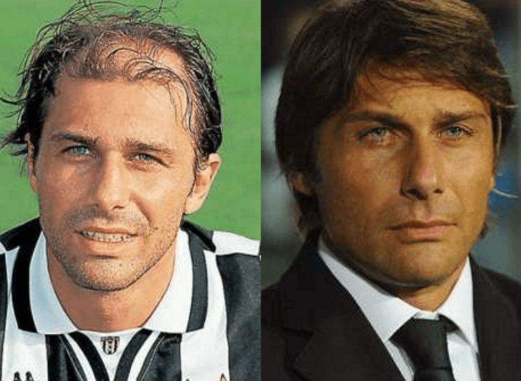 mariobianchi18's tweet photo. Il #31luglio 1969 è nato #AntonioConte. Tenace centrocampista di Lecce e Juventus (5 scudetti) ha sfondato da mister (25 gare con l'Italia) con il suo carattere bellicoso ed impetuoso. 3 scudetti con Juve (3 panchine d'oro), uno con l’Inter (con Coppa d’Inghilterra) e Chelsea. https://t.co/gW3MzX5XJB