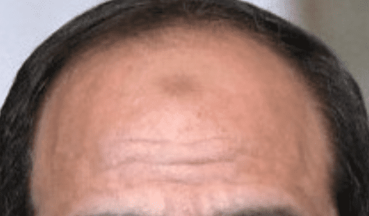 AlertesInfos's tweet photo. 🇫🇷 FLASH | Adam (prénom modifié), qui rêvait de devenir policier, avait vu sa candidature rejetée en 2021 en raison d’une "tabâa", une marque pouvant apparaître sur le front de certaines personnes pratiquant régulièrement la prière musulmane. 

L’administration avait estimé que cette "marque liée à une pratique religieuse assidue" était "incompatible avec les exigences de laïcité et de neutralité attachées aux fonctions de policier".

5 ans plus tard, le Conseil d’État lui donne raison : cette décision est annulée et Adam peut désormais présenter sa candidature pour intégrer la police.

(Le Parisien)