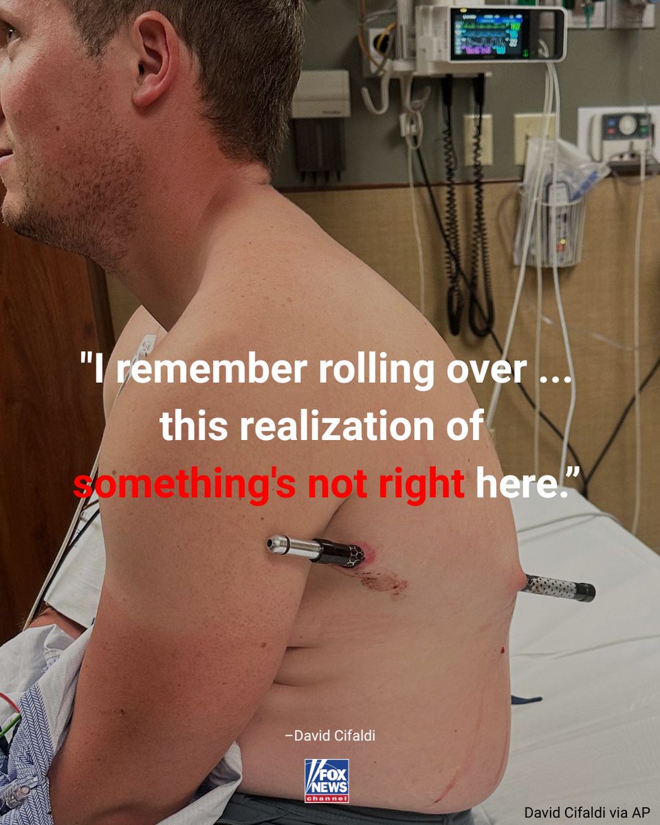 Meganm5fe's tweet photo. An ER nurse hiked more than 10 miles to safety after a trekking pole pierced his side during a climb on Montana’s Granite Peak. https://t.co/HosiZtLq5J