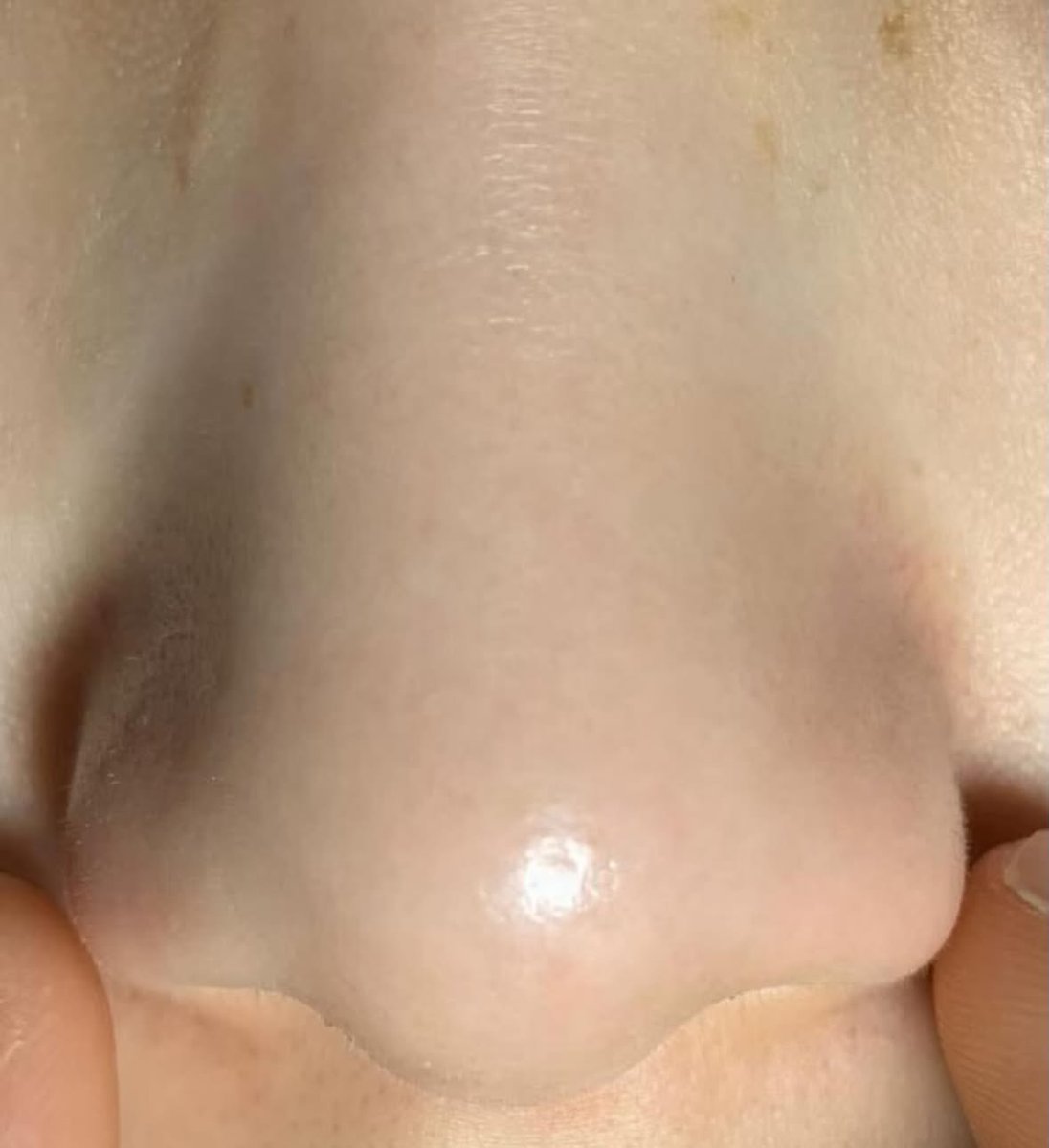 jusingfo's tweet photo. Makasih kak gitasav udah rekomen ini!!! 🙇🏼‍♀️

Ini beneran bikin blackheads kayak lumer gitu. Hidung langsung smooth, sebum jadi soft and it wipes off sooo easy. Satisfying parah.￼ https://t.co/IDwvhibR8H