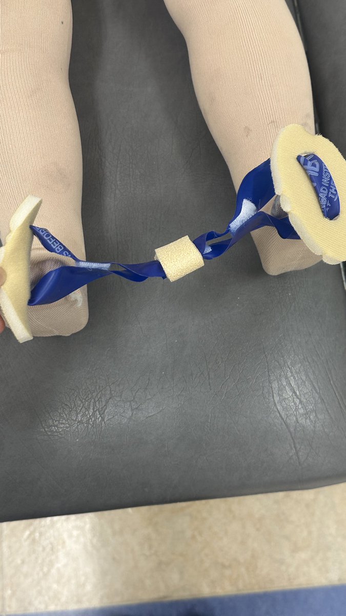 RMD_OTS's tweet photo. فكرة صغيرة داخل ورشة Splinting… تحولت إلى أول Creative Splint أصممه https://t.co/KdcCx1230x