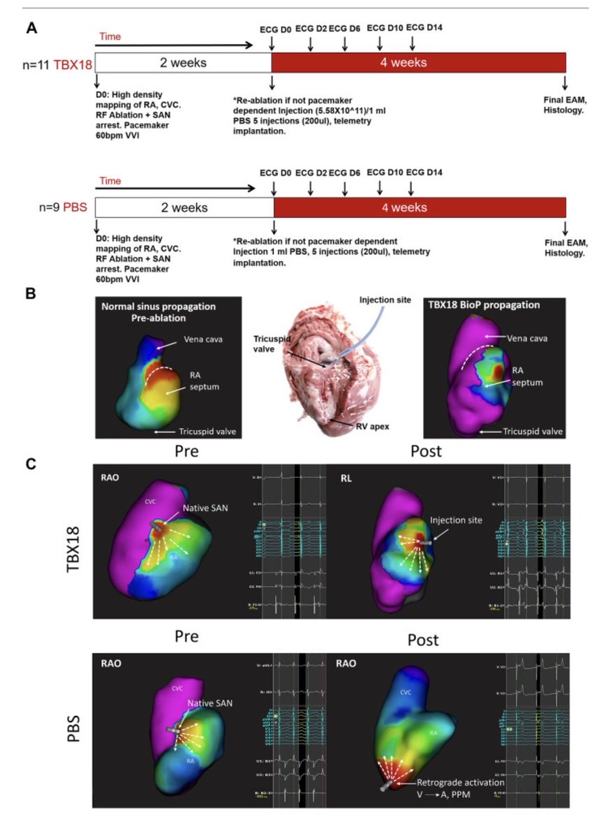 EugenioCingolan's tweet photo. New work on #Biopacer to treat #SAN dysfunction in a swine model of #SAN disease published in #JACCEP @JACCJournals - #Biopace #CRM https://t.co/OQ2nHM9hCu