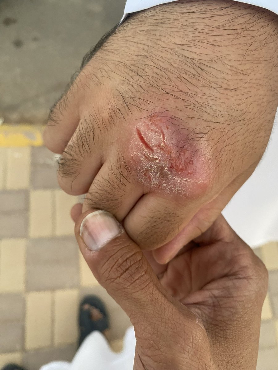 AlKHWAITER's tweet photo. خل الدجاج وتنقطع عنك الأمراض
والجسم يتعافى على خلقة الله
كنك طلعت الحين من تحت الأنقاض
سالم من الأعراض ما فيك علّه

الأخ @MOHAMME99487423 
#نظام_الطيبات https://t.co/W61MX1gxc5