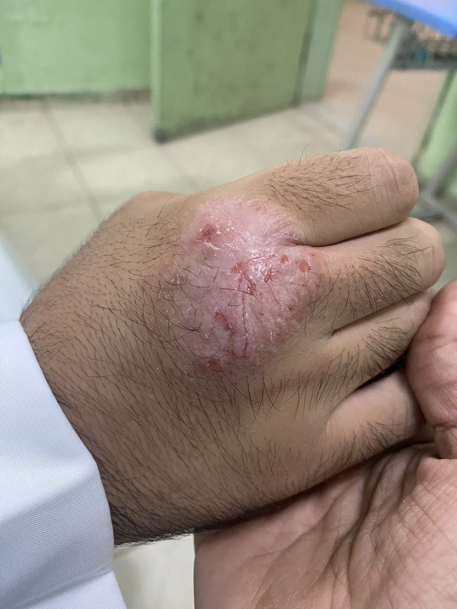 AlKHWAITER's tweet photo. خل الدجاج وتنقطع عنك الأمراض
والجسم يتعافى على خلقة الله
كنك طلعت الحين من تحت الأنقاض
سالم من الأعراض ما فيك علّه

الأخ @MOHAMME99487423 
#نظام_الطيبات https://t.co/W61MX1gxc5
