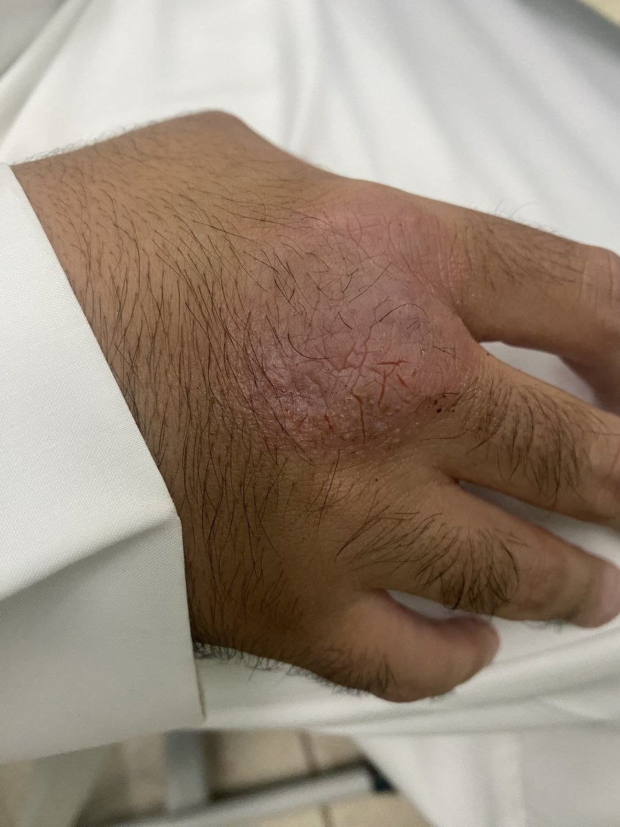 AlKHWAITER's tweet photo. خل الدجاج وتنقطع عنك الأمراض
والجسم يتعافى على خلقة الله
كنك طلعت الحين من تحت الأنقاض
سالم من الأعراض ما فيك علّه

الأخ @MOHAMME99487423 
#نظام_الطيبات https://t.co/W61MX1gxc5