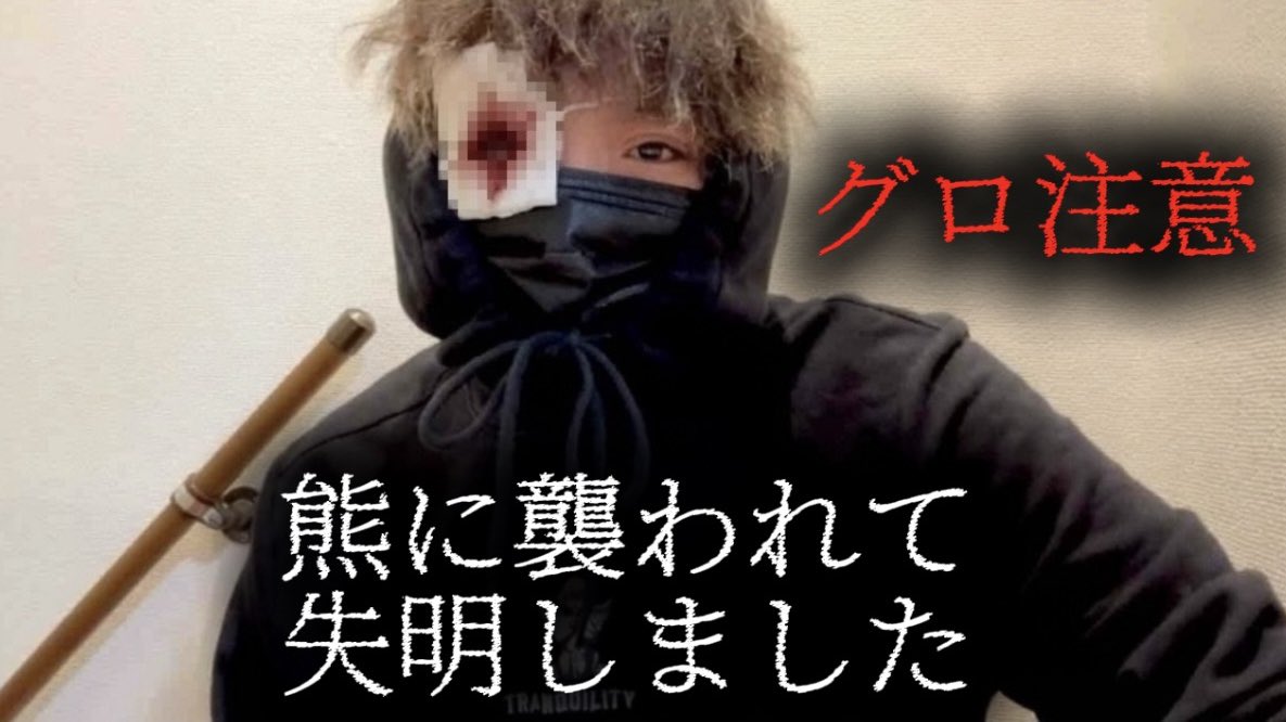 24k_hamster's tweet photo. 【閲覧注意】家の目の前で熊に襲われて失明しました https://t.co/WYjx7QyYOf @YouTubeより https://t.co/bLuSAe2ejV