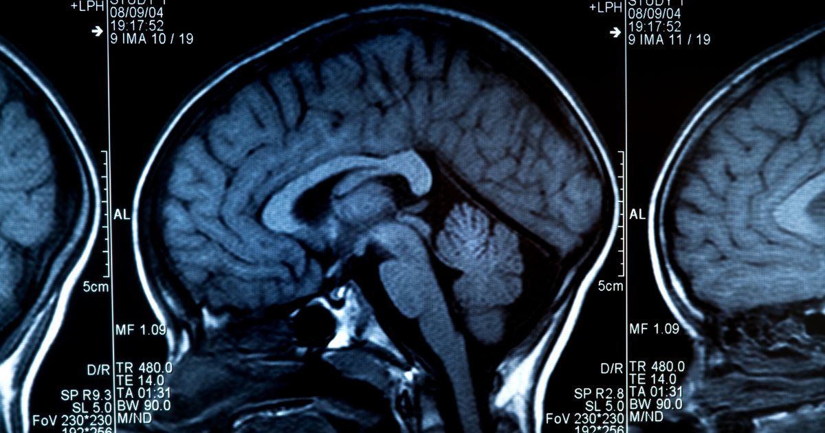 Brain Inflammation Collaborative tweet media