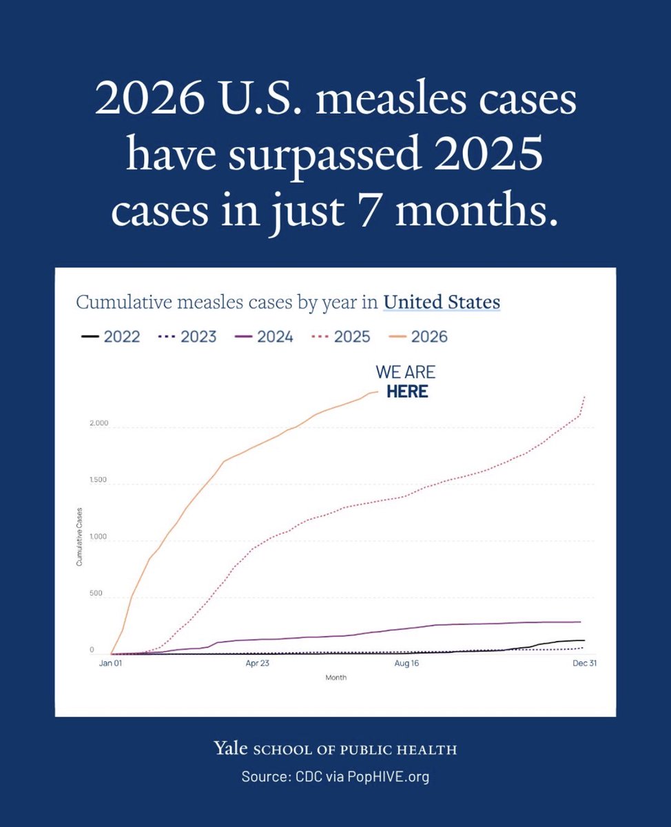 JeromeAdamsMD's tweet photo. Measles doesn’t “build immunity” - it kills & disables.

Short-term: Pneumonia (1/20 kids, top cause of death), encephalitis (1/1,000 → brain damage/death), 1–3 deaths per 1,000 children.

Long-term: Immune amnesia (months–years of weaker defenses) + SSPE (rare, almost always fatal brain disease years later).

More cases = LESS health. And we’ve had more cases in the last 2 years than the last 20 COMBINED. 🤯