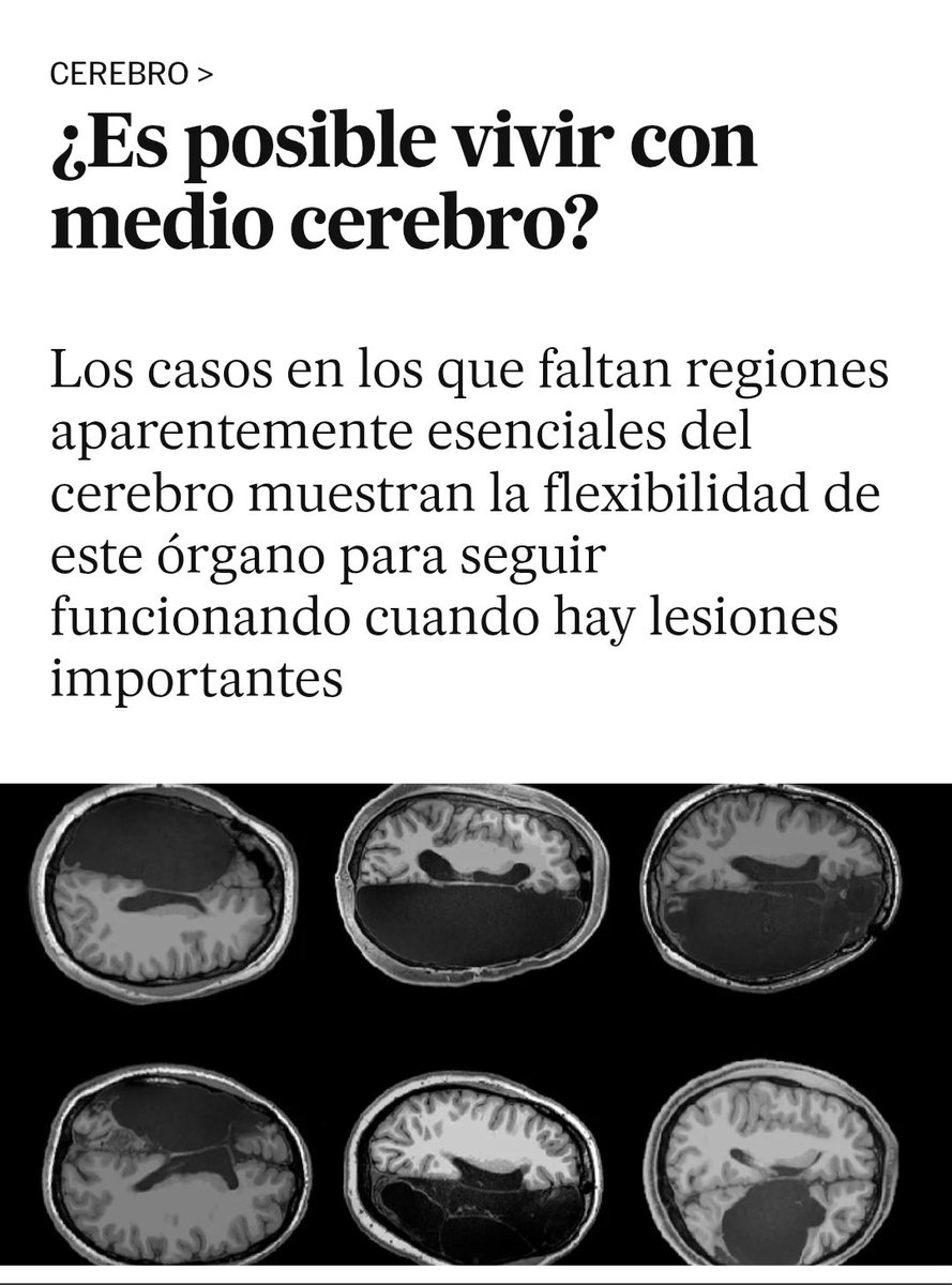 SergioLarRus's tweet photo. @nicogoncas Felicidades Nicolas, eres la prueba viviente.

Oye, para reirnos todavia mas, en tu honorable y sacrificado trabajo de eurodiputado, al mes en bruto, que te ventilas ¿5000 euros? ¿6000 euros? ¿7000 euros? https://t.co/Tw9JSUBt2S