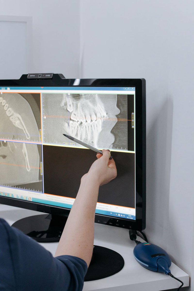 StDentistry's tweet photo. The gag-reflex memory from childhood impression putty is still why some people avoid the dentist. 😬 

That putty doesn't exist here anymore — a scanner maps your whole mouth in under a minute. 
We replaced it years ago. 

#DentalTech #StPetersMO https://t.co/lzDupKbeGu