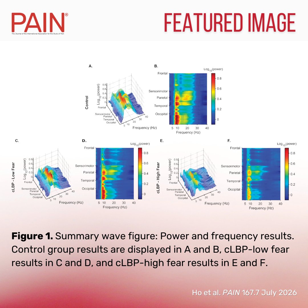 PAINthejournal's tweet photo. In this week’s #PAIN Featured Image, Ho et al. depict the marginal means from ANCOVA analysis and show frequency, periodic power, and location data for each group. Chronic low back pain and high fear is associated with lower resting alpha and beta power https://t.co/Yq8gOF817V https://t.co/KAvgQYztwG