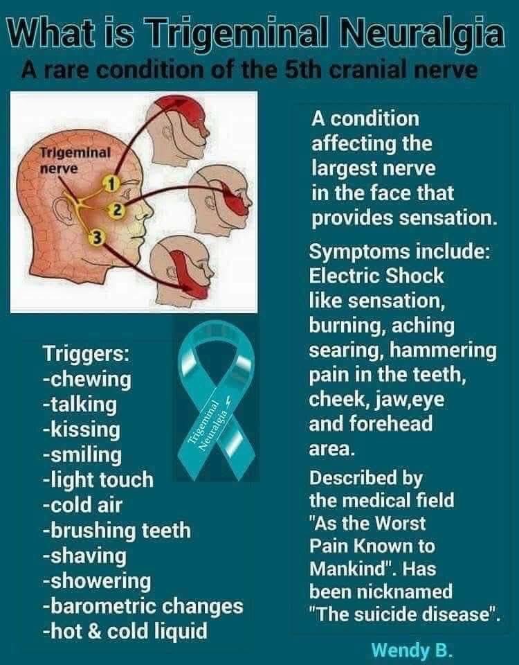 SaudiaFW's tweet photo. Radiation for Trigeminal neuralgia https://t.co/RNrKL755Ie