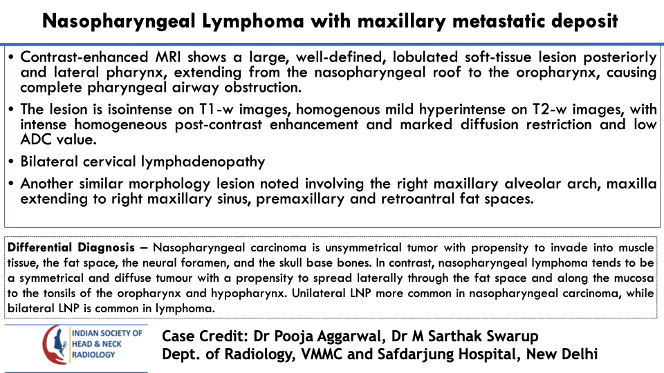 teamishnr's tweet photo. #caseoftheweekanswer

Please find the answer
#radiology #caseoftheweek #headandneck #radiologycases #dailywork #ISHNR #teaching #research #imaging #FOAM #FOAMRad #FOAMMed

Visit our website: https://t.co/27hxmhFkCF
All Cases: https://t.co/0xaPvoBy5H https://t.co/6KngY0ozB1