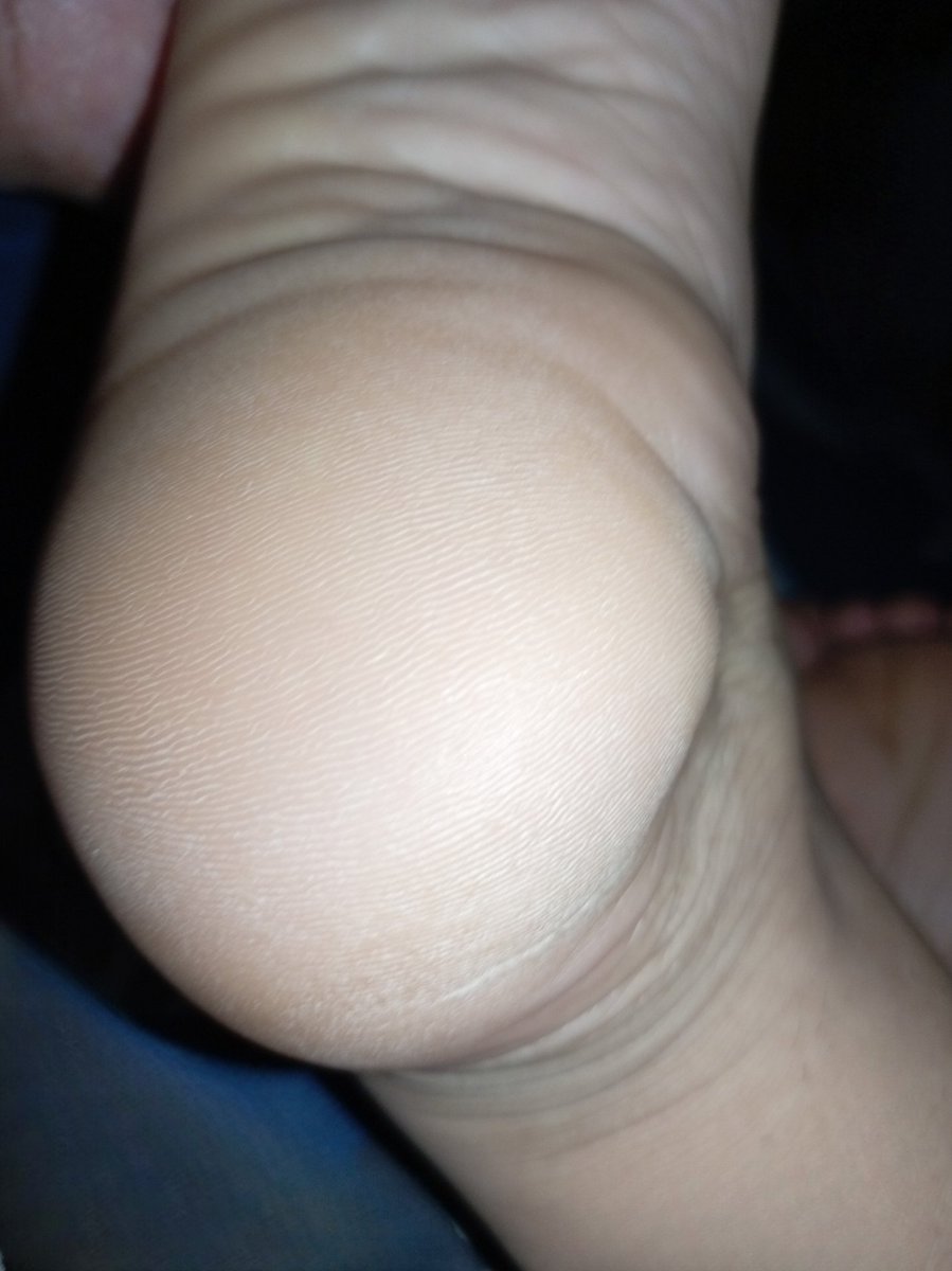 carminafeet12's tweet photo. Mis Talones les desea un Feliz y Hermoso Viernes 👣🤗 #pies #piessudados #olor #oloraqueso #piesudados #dedos #dedogordo #deditos #footfetısh #feetfetısh #natural #foot #closeup #soles #plantadelospies #plantas #arrugas #dedosapretados #fetiche #fetichedepies #talón #talones https://t.co/hhF6fhqiPQ