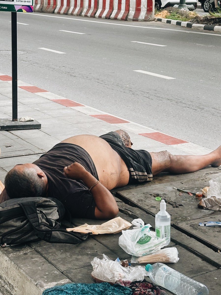 Mirror_org's tweet photo. เขาเป็นผู้ป่วยถูกพูดถึงอย่างมากในโลกออนไลน์
.
ถูกถามถึงว่าเขาเป็นใครกันแน่ หลายข้อมูลบอกว่าเขาเป็นนักบิน 
เขาเป็นคนชาติไหน หน้าตาไม่ใช่คนไทย หลายข้อมูลบอกว่าคนฟิลิปปินส์ 
อะไรที่ทำให้เขาต้องมาเร่ร่อนอยู่ข้างถนน หลายข้อมูลบอกว่าเพราะเจ๊งเล่นหุ้น
.
ในฐานะที่กระจกเงาให้ความช่วยเหลือผู้ป่วยคนดังกล่าว กระจกเงาจะขอเล่าในเรื่องที่สังคมไม่ค่อยได้ถาม
.
เราช่วยเหลือเขาได้อย่างไร ???
ทั้ง ๆ ที่มีหน่วยงานลงมาให้ความช่วยเหลือแต่ไม่เคยได้ไปถึงโรงพยาบาล…
.
ก่อนลงพื้นที่เรามีสมมุติฐานอย่างหนึ่งจากการทำงานกับผู้ป่วยจิตเวชเร่ร่อนมานับ 10 ปี  เราพบว่ามีผู้ป่วยจิตเวชเร่ร่อนหลายคนที่สภาพร่างกายมีปัญหา มีแผลติดเชื้อ และก็พบว่าทุกคนไม่ได้สนใจต่อบาดแผลของตัวเองแต่อย่างใด หลายคนให้ข้อมูลบิดเบือนกับบาดแผลนั้น มีอยู่เคสหนึ่งเขาระบุตัวเองว่า ร่างนี้ไม่ใช่ร่างของเขา ร่างของเขาถูกเก็บอยู่ในห้องแช่แข็ง
.
ดังนั้นเมื่อลงพื้นที่เคสนี้ เราจึงสังเกตทั้งอาการเจ็บป่วยของเขา แผลที่ติดเชื้อ และพฤติกรรมที่พอชี้ได้ว่ามีปัญหาสุขภาพจิต เราไม่พบการพูดคนเดียว แต่มีข้อมูลจากผู้คนแถวนั้นที่บอกว่าเขาพูดคนเดียวบ่อยครั้ง เขาวานให้ไปซื้อแคปซูลมะระขี้นกด้วยเหตุผลเอามารักษาแผลที่น่าจะเกิดจากเบาหวาน มีข้อมูลที่บอกว่าเขามักจะบอกว่าแผลนี้อีก 3-4วัน ก็หาย มีหลายครั้งที่มีคนมาทำแผล หลังคนทำแผลจากไป เขาแกะออกในทันที หรือในวันที่น้ำเหลืองน้ำเลือดออกมาผิดปกติ เขาจะนำมันมาปาดตามเนื้อตัว เมื่อได้ข้อมูลดังนั้นเราจึงประสานตำรวจเพื่อนำส่งรักษาตาม พรบ.สุขภาพจิต ทันที เมื่อตำรวจมาถึง รถพยาบาลมาถึง ตัวผู้ป่วยไม่ปฏิเสธการรักษาใด ๆ ยินยอมไปรักษา
.
เมื่อถึงโรงพยาบาลทางกาย เรายืนยันสิทธิ์ความเป็นมนุษย์ของผู้ป่วยที่จะได้เข้ารับการรักษาอย่างเร่งด่วน การเข้ารับการตรวจวินิจฉัยและรักษาโรคทางกายจึงเป็นความจำเป็นเร่งด่วนในอันดับแรก อันดับต่อไปคือ เข้ารับการตรวจวินิจฉัยรักษาโรคทางจิตเวช
.
เขาเป็นอย่างไรบ้างในตอนนี้ ???
.
ตอนนี้ทางผู้ป่วยถูกดูแลอย่างใกล้ชิดจากทางแพทย์และพยาบาล และถูกดูแลอย่างใกล้ชิดในด้านทางสังคมจากทางนักสังคมสงเคราะห์ของโรงพยาบาลหนึ่ง
.
แล้วหลังจากสิ้นสุดการรักษา จะเอาอย่างไรต่อ ???
.
เรื่องดังกล่าวทางฝ่ายสังคมสงเคราะห์ของโรงพยาบาล จะเป็นกลไกหลักในการนำสืบ หาตัวตนที่ถูกต้องของผู้ป่วย ชื่อ นามสกุล ที่อยู่ของครอบครัว อาชีพ ข้อมูลทางสังคมอื่น ๆ สัญชาติ รวมถึงประสานงานกับหน่วยงานที่เกี่ยวข้องในการดูแลผู้ป่วยคนนี้ เมื่ออาการทางร่างกายและอาการทางจิต (ถ้ามี) ถูกรักษาและทุเลาเบาบางลง และทางมูลนิธิกระจกเงาจะเข้าช่วยสนับสนุนในการสืบค้นตัวตนของผู้ป่วย และประสานกับหน่วยงานในครั้งนี้ด้วย ซึ่งใน 2 วันที่ผ่านมา เราได้รับการติดต่อจากหลายหน่วยงานที่เกี่ยวข้อง รวมถึงสถานทูตของประเทศที่ปรากฏเป็นข้อมูลในข่าวออนไลน์ และเรากระจกเงารับประกันว่าเราจะไม่ให้เขาต้องตกหล่นมาอยู่ที่ข้างถนนอีกครั้งอย่างแน่นอน
.
คำถามสุดท้ายที่มูลนิธิกระจกเงาอยากชวนสังคมตั้งคำถามที่ไปให้ได้มากไปกว่า คำถามว่า เขาเป็นใครกันแน่ และชีวิตทำไมถึงตกต่ำลงขนาดนี้ มาเป็นคำถามที่ถามดัง ๆ ว่า ทำไมในช่วงเวลาเกิน 1 อาทิตย์ มนุษย์ 1 คนพร้อมกับสภาพร่างกายที่อ่อนแอและแผลที่เห็นได้ชัดเจน ทั้งภาพและกลิ่นนั้น ทำไมเขาถึงไม่สามารถเข้าสู่การรักษาได้ตั้งแต่วันแรกที่มีผู้พบเห็น หรือมีหน่วยงานของรัฐมาลงพื้นที่ในวันแรกนั้นได้ มันต้องมีอะไรผิดปกติหรือไม่ในระบบการช่วยเหลือผู้คน มันต้องมีอะไรผิดปกติใช่หรือไม่ ที่มนุษย์ต้องตกอยู่ในชะตากรรมเช่นนี้
.
เราหวังว่านี่จะเป็นคำถามที่สังคมสนับสนุนและนำไปถามต่อกับผู้ที่เกี่ยวข้อง โดยเฉพาะรัฐที่เราสังกัดอยู่
____________
**หมายเหตุข้อมูล เรื่องอาชีพ สัญชาติ ของผู้ป่วยรายนี้นั้น ทางมูลนิธิกระจกเงาไม่ได้ทำการนำเสนอข้อมูลดังกล่าว เพราะเราทราบดีว่าตัวผู้ป่วยยังไม่พร้อมในการให้ข้อมูล แต่ที่ถูกนำเสนอในข่าวออนไลน์นั้น เกิดจากสำนักข่าวออนไลน์สำนักหนึ่งได้นำมาจากเฟซบุ๊กของพลเมืองดีท่านหนึ่งที่เข้าไปคุยกับผู้ป่วย และได้นำไปนำเสนอในเฟซบุ๊กส่วนตัว