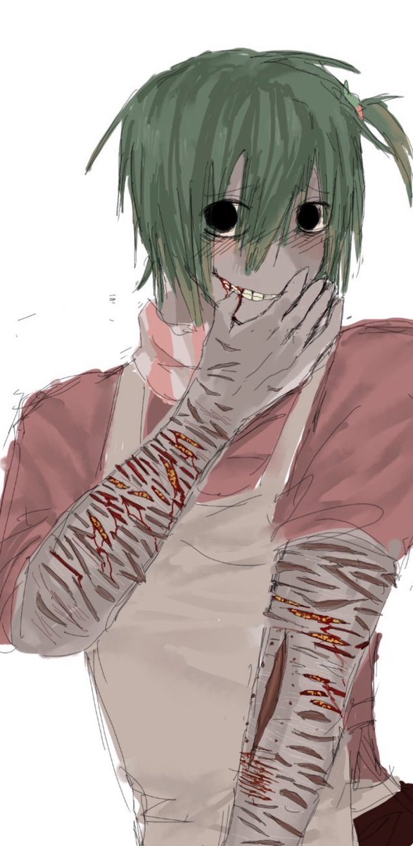mqxlnm's tweet photo. Scars Ugly🫠 https://t.co/mDPLu46Qwv