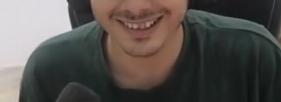 GeorgeByTW's tweet photo. Warning!! strong image below. 

Latest news, Mohamed Light has just been shot 10 thousand times by a dark goblin evolved on his tooth. 🤯

#mohamedlight #nomoneyfordentist #disabledteeth #disableparkingspot #imscared #terrormovie #caosmodetooth #hogridercolourtooth https://t.co/GLd1VmL34M