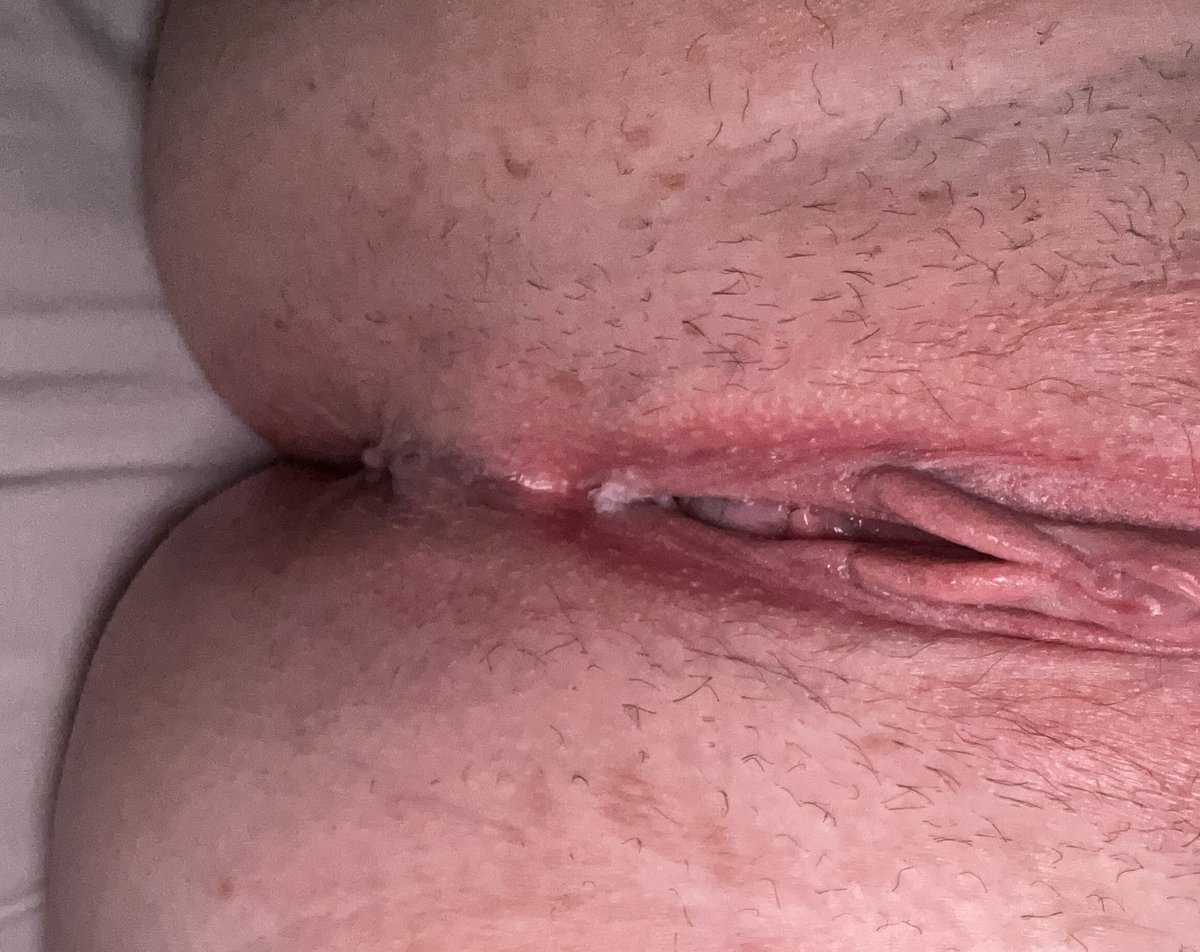 lilbxbybatxo's tweet photo. my tight holes would look so good with a superior woman’s cum leaking out of them 🥺
#tnwo #t4c #c4t #transsupremacy #pussy #cuntgirl #cunt #nsfw #bbw #fatpussy https://t.co/fQmhVVrvF1