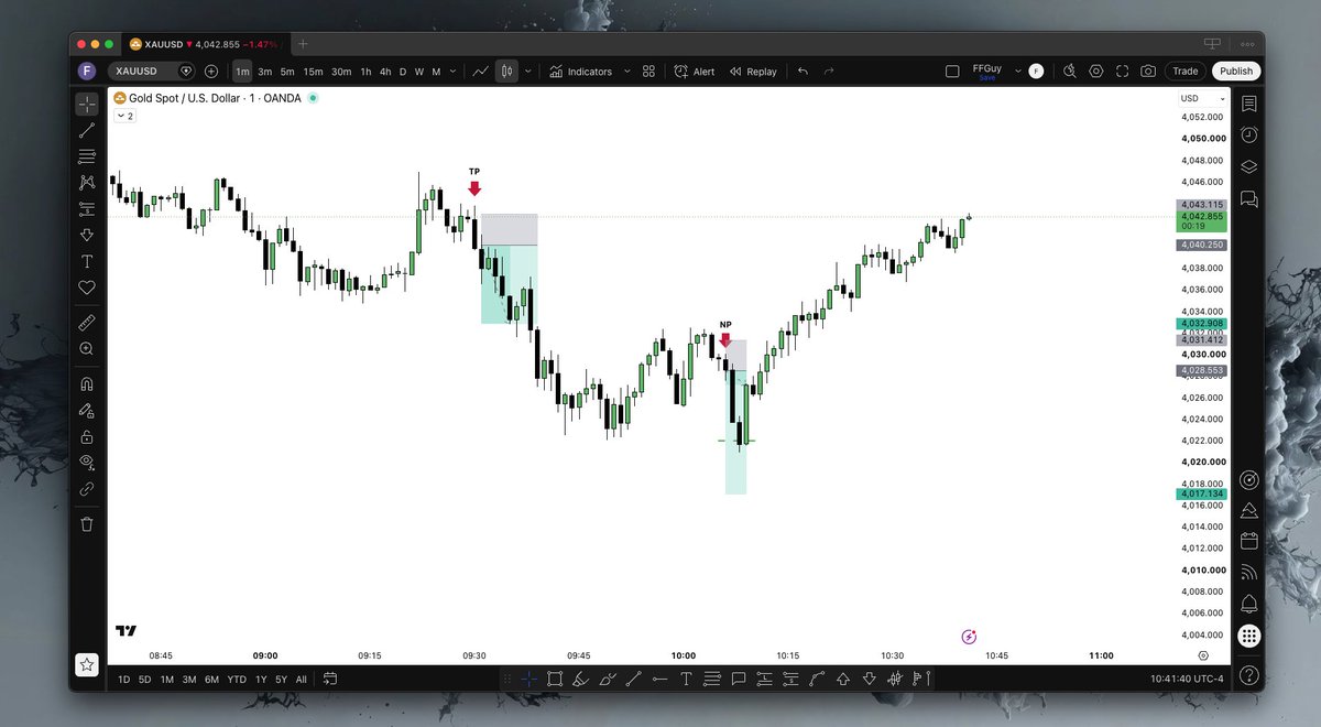 FrumFinanceGuy's tweet photo. Today I played gold right at the open, and because of that I was stressed and cut the entire position at the first chance instead of letting a partial run, even though price was very clearly bearish. 
Right after I cut it, another signal showed up on Nas, but by the time I finished analyzing it, price was already gone, so I didn't play it. 
Beautiful trade, shame. 
That's also live trading, the randomness of the real thing, far from the cozy predictions of a backtest.

Another signal came up on Nas that I didn't play because a rule of mine forbids it, then another good signal on gold that I missed, probably would've taken a partial and let the rest end at BE. 
Then a signal on Nas, SL.

Volatility seems to have calmed down, and we're approaching 5 PM in Europe, known as the closing time for London swing traders the friday, which can cause range conditions. 
So I'm stepping away from the screens, closing out my week and my month.

Have a good weekend, everyone.