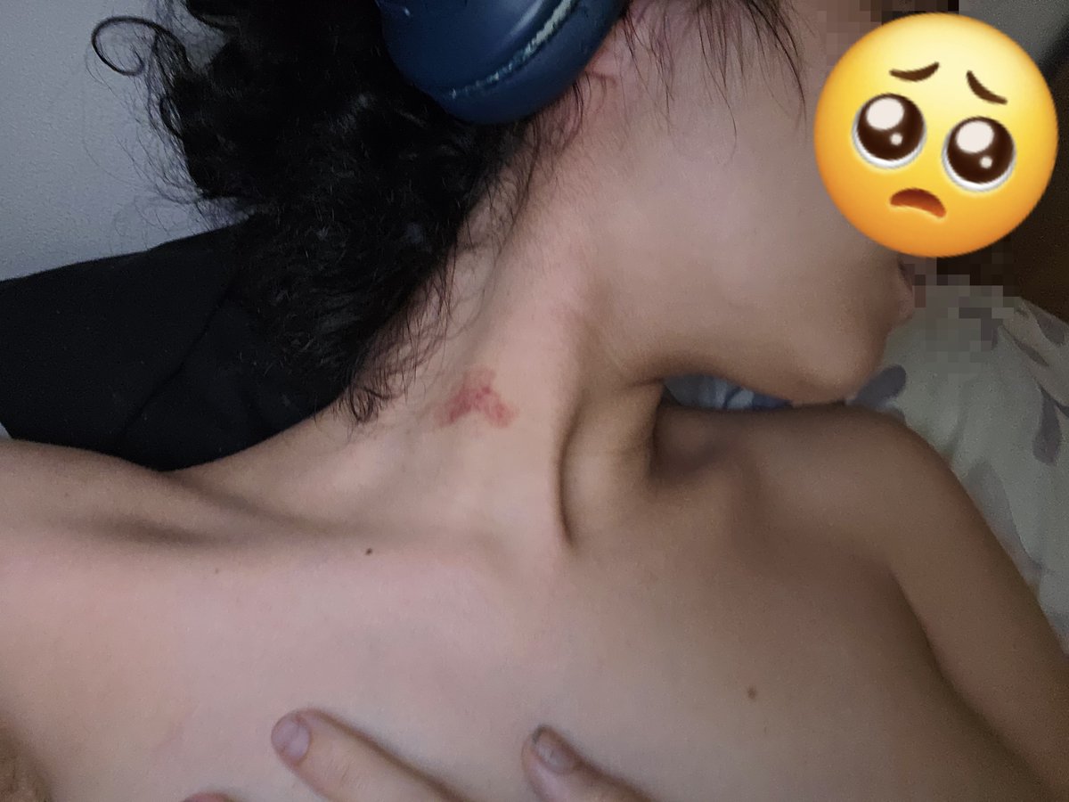 bubucocoin's tweet photo. meu maridinho deixa marcas em mim, para mostrar q sou só dele 🥺🧸 
oq acharam? https://t.co/DX2OPESxVL
