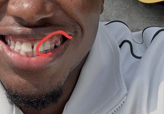 emizyfx's tweet photo. My idolo, abeg fix this teeth. Fly fee enter there. 😭💔😂 https://t.co/DJ74LsVgYH