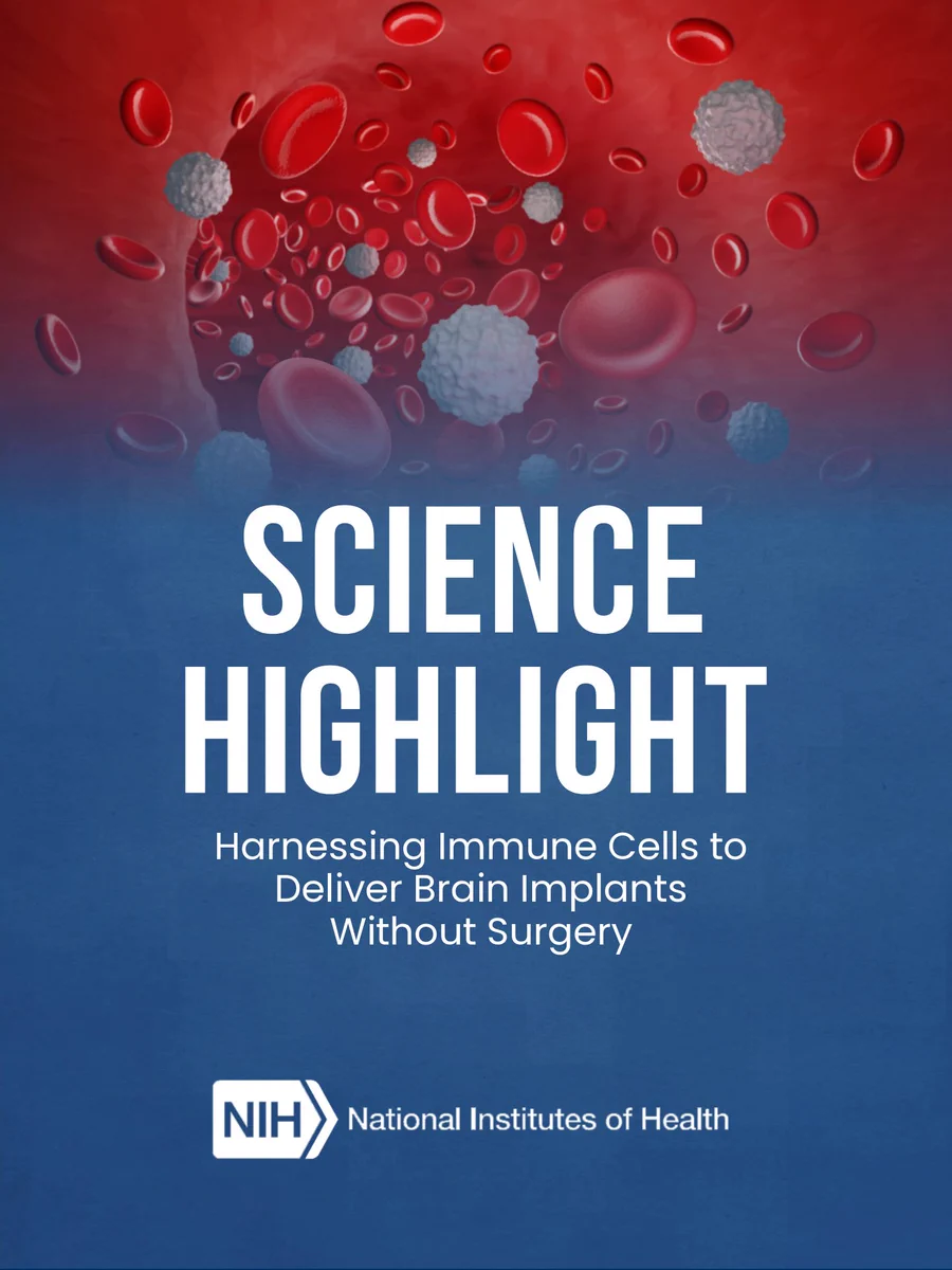 Image of red and white blood cells. Text reads: Science Highlight. Harnessing Immune Cells to Deliver Brain Implants Without Surgery. NIH logo is shown.