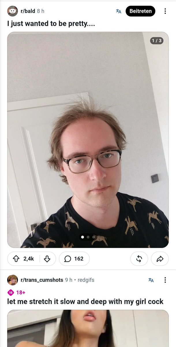 SvenWeisswein's tweet photo. Reddit ist ein Witz digga r/bald und alles was ich sehe sind junge Männer in der Blüte ihres Lebens mit vollem Haar https://t.co/oW0rVQrCcp