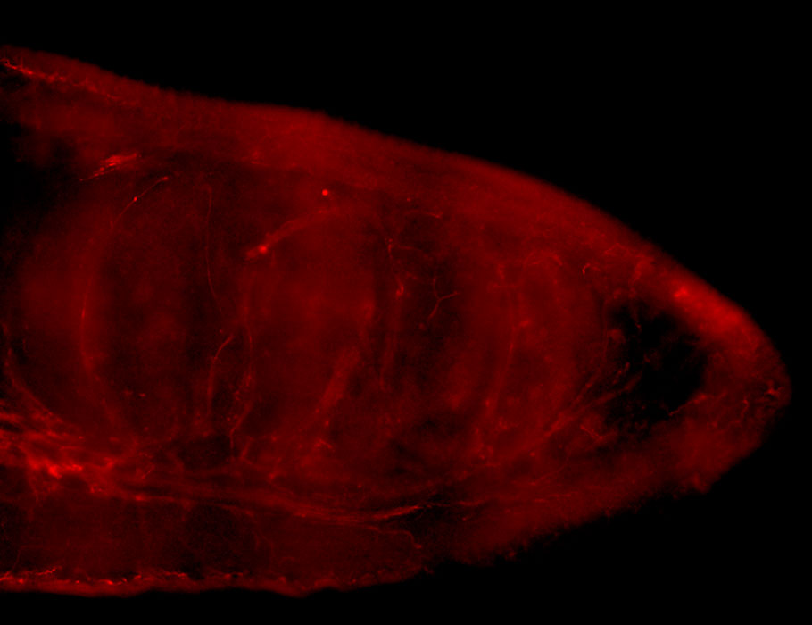 ScienceTM's tweet photo. An analysis of patient data and mice untangles how sympathetic and sensory nerve crosstalk drives progression of oral cancer and triggers neuropathic pain by raising adrenergic sensitivity and peripheral neuroplasticity. @nicole_scheff @PittTweet https://t.co/QV37MIa8EG https://t.co/1mDgKheMQ7