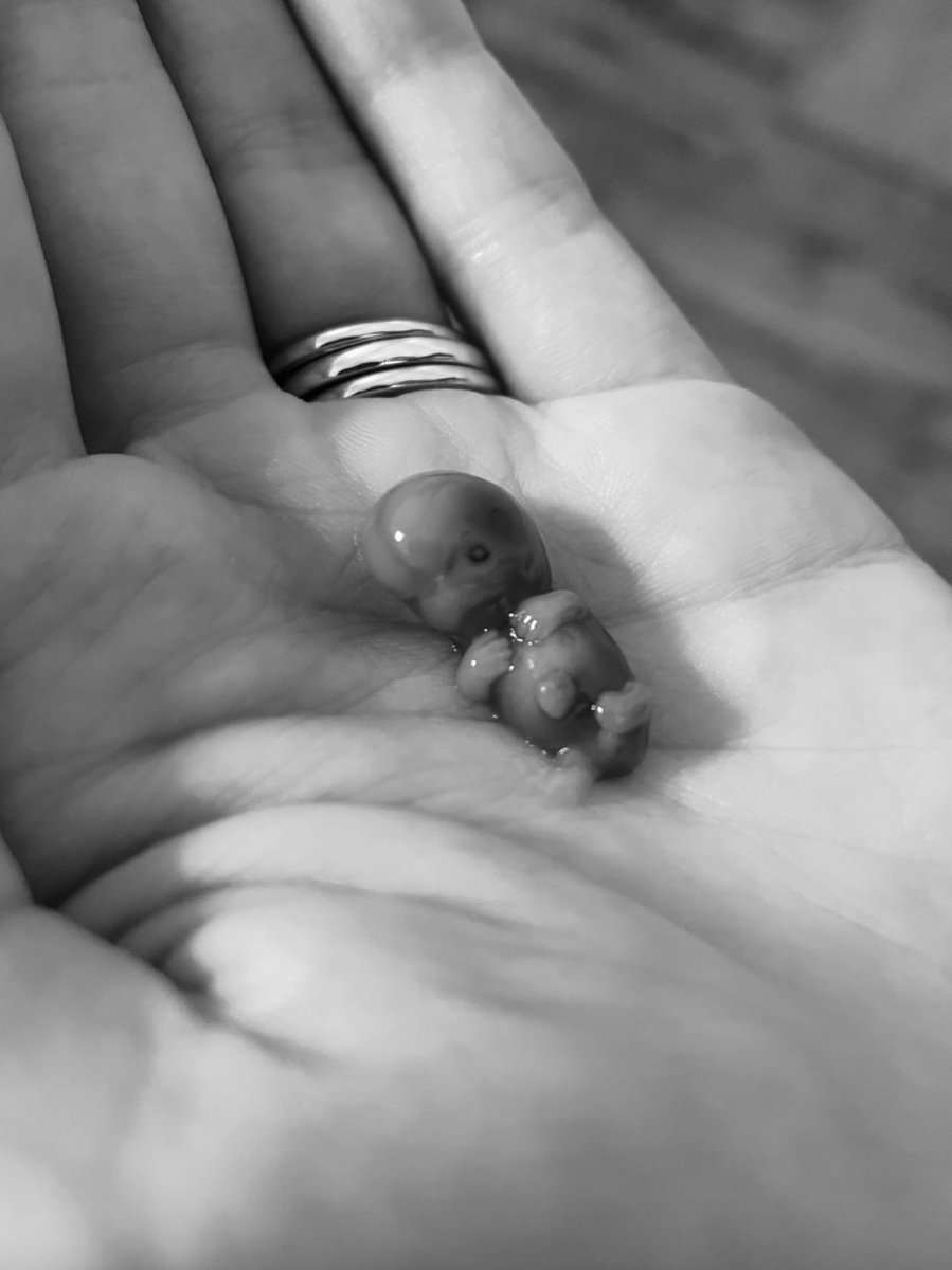 iarsuaga's tweet photo. Priscilla perdió a su bebé a las nueve semanas y decidió mostrarlo al mundo. Tan pequeño, tan frágil y plenamente humano. Toda vida merece amor y respeto. https://t.co/SznIlHWXaE
