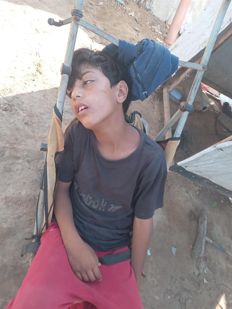 4CNa1JQyA398425's tweet photo. My brother is seriously ill and urgently needs treatment. We are a family of 8 with no father or support. Please help us by sharing or supporting us. 🙏🇵🇸 https://t.co/bjysGIiBVI