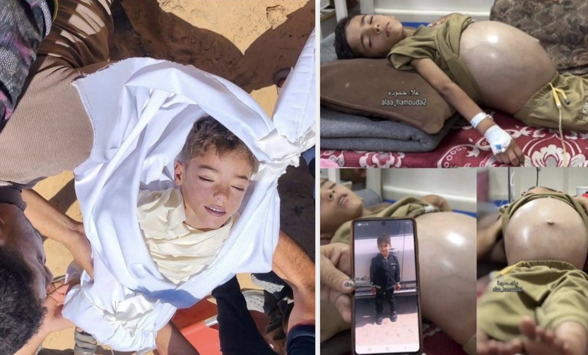 swilkinsonbc's tweet photo. Palestinian child Yaamen Baroud dies after battling cancer in Gaza, where israelis made treatment unavailable &amp; denied him specialist care https://t.co/EXexIxPrEC