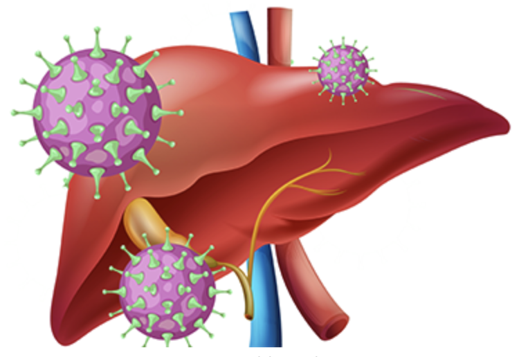IDSE_Online's tweet photo. 🧬 New phase 3 data: Investigational BEM/RZR was noninferior to Epclusa for hepatitis C—and could offer an 8-week treatment option if approved.
Read more: https://t.co/ZOmuflyQhO
#HepatitisC #HCV #ClinicalTrials https://t.co/HDB47swLyK