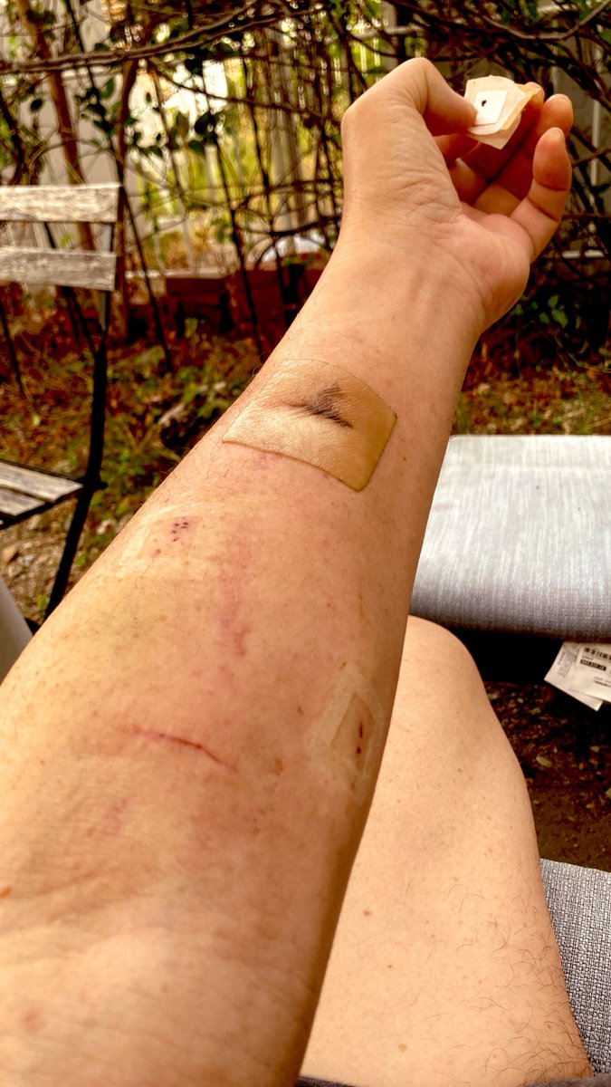 kaz6thlife's tweet photo. ãMy #dialysis #simptom's memoã
ð¥ðð©ââïžð©žðð©»â¿ïžðªð¥Œð¡ïž
â¥No need to commentâ£ïž https://t.co/XFG6MqeLaE