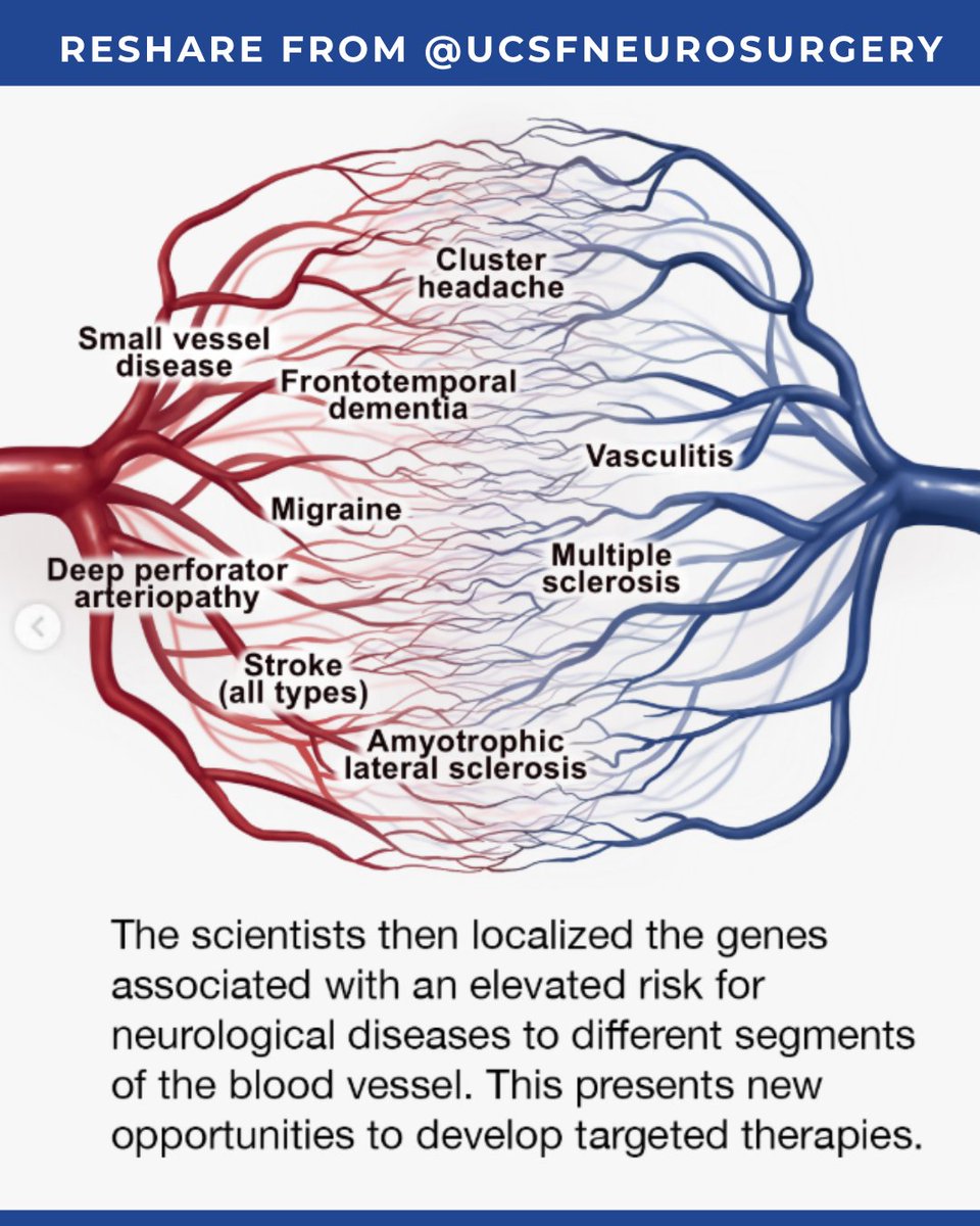 TAAF's tweet photo. Congratulations to @EthanWinklerMD and the Winkler Lab on today's Cell publication. A major step forward for brain aneurysm, AVM, stroke, and cerebrovascular research.

Shared with permission from @UCSFneurosurgery https://t.co/52QbEYrwwS