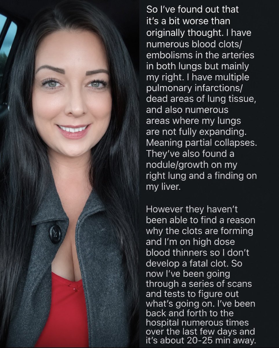 toobaffled's tweet photo. Heidi has numerous blood clots/embolisms in her lungs 🫁 ..
She has multiple pulmonary infarctions/dead areas of lung tissue. And numerous areas where her lungs are not fully expanding.. https://t.co/V8ZeinovoX